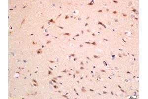 Paraformaldehyde-fixed, paraffin embedded rat brain, Antigen retrieval by boiling in sodium citrate buffer (pH6) for 15min, Block endogenous peroxidase by 3% hydrogen peroxide for 30 minutes, Blocking buffer (normal goat serum) at 37°C for 20min, Antibody incubation with Rabbit Anti-C1QC/C1QG Polyclonal Antibody, Unconjugated  at 1:200 overnight at 4°C, followed by a conjugated secondary for 90 minutes and DAB staining.