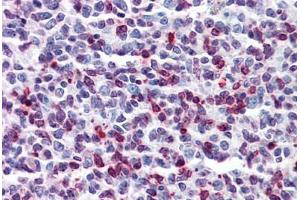 Human Tonsil: Formalin-Fixed, Paraffin-Embedded (FFPE)