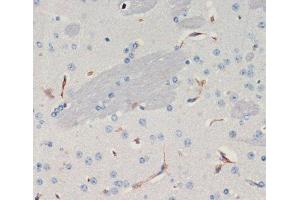 Immunohistochemistry of paraffin-embedded Mouse brain using THBS1 Polyclonal Antibody at dilution of 1:200 (40x lens). (Thrombospondin 1 anticorps)