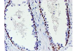 Image no. 2 for anti-WW Domain Containing Transcription Regulator 1 (WWTR1) antibody (ABIN1501763) (WWTR1 anticorps)