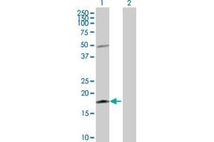 Western Blot analysis of IL21 expression in transfected 293T cell line by IL21 MaxPab polyclonal antibody. (IL-21 anticorps  (AA 1-162))