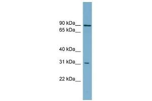 ABCD2 antibody used at 1 ug/ml to detect target protein. (CCL17 anticorps)