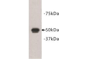 Western Blotting (WB) image for anti-FAT Tumor Suppressor Homolog 1 (FAT1) antibody (ABIN1854969) (FAT1 anticorps)