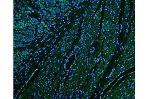 IF analysis of CD39/ENTPD1 using anti-CD39/ENTPD1 antibody (ABIN7602461).