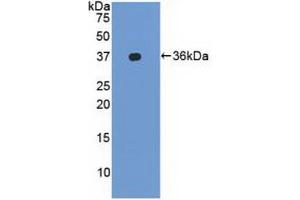 Western blot analysis of recombinant Human LFA1a. (ITGAL anticorps  (AA 809-1066))