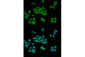 Immunofluorescence analysis of HeLa cell using UPF1 antibody. (RENT1/UPF1 anticorps)