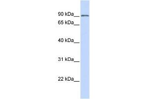 WB Suggested Anti-TRIM28 Antibody Titration: 0. (KAP1 anticorps  (N-Term))