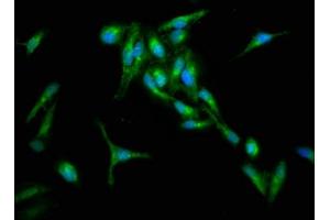 Immunofluorescence staining of Hela cells with ABIN7167114 at 1:133, counter-stained with DAPI. (RIN1 anticorps  (AA 192-341))