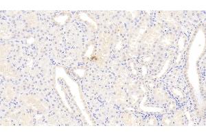 Detection of CYPB in Human Kidney Tissue using Monoclonal Antibody to Cyclophilin B (CYPB)
