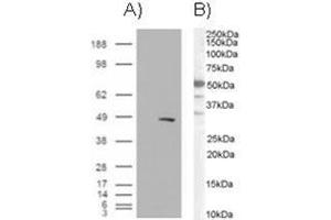 Image no. 1 for anti-SWI/SNF Related, Matrix Associated, Actin Dependent Regulator of Chromatin, Subfamily E, Member 1 (SMARCE1) (C-Term) antibody (ABIN374349) (SMARCE1 anticorps  (C-Term))