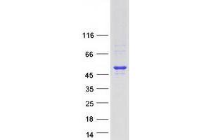Validation with Western Blot