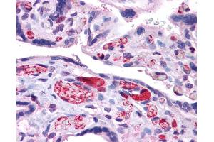 Immunohistochemistry (IHC) image for anti-Arginase, Liver (ARG1) (N-Term) antibody (ABIN2782309)