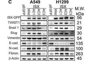 Sequencing analysis of acetylated recombinant and trypsin-digested wild-type ISX using liquid chromatography-mass spectrometryA, BPCAF acetylation of ISX was detected at lysine residue 69 by liquid chromatography-tandem mass spectrometry (LC-tandem MS-MS). (Vimentin anticorps)