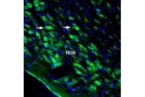 Expression of Homer3 in rat nucleus basalis - Immunohistochemical staining of perfusion-fixed frozen rat brain sections with Anti-Homer3 Antibody (ABIN7043275, ABIN7045172 and ABIN7045173), (1:1000), followed by goat anti-rabbit-AlexaFluor-488.