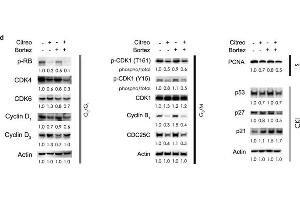 Combination of bortezomib and citreoviridin inhibited cell cycle progression through different cell cycle regulators. (PCNA anticorps)
