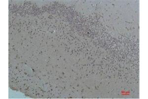 Immunohistochemistry (IHC) analysis of paraffin-embedded Rat Brain Tissue using Bestrophin-1 Rabbit Polyclonal Antibody diluted at 1:200. (Bestrophin 1 anticorps)