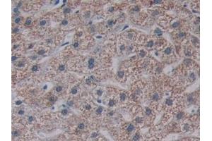 Detection of TMPRSS4 in Human Liver Tissue using Polyclonal Antibody to Transmembrane Protease, Serine 4 (TMPRSS4)