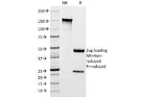 SDS-PAGE Analysis Purified Cytokeratin 10 Mouse Monoclonal Antibody (SPM261). (Keratin 10 anticorps)