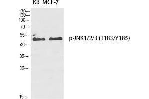 Western Blot analysis of KB (1), MCF-7 (2), diluted at 1:2000. (JNK anticorps  (pThr183))