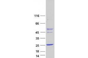 Validation with Western Blot