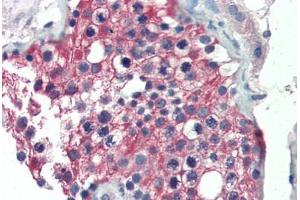 Human Testis (formalin-fixed, paraffin-embedded) stained with ALDH1A1 antibody ABIN337223 at 2. (ALDH1A1 anticorps  (AA 476-488))