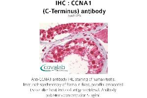 Image no. 1 for anti-Cyclin A1 (CCNA1) antibody (ABIN1732738) (Cyclin A1 anticorps)