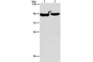 Western Blot analysis of Mouse heart and brain tissue using MARK1 Polyclonal Antibody at dilution of 1:500 (MARK1 anticorps)
