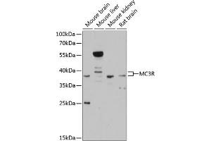 Western blot analysis of extracts of various cell lines, using MC3R antibody (ABIN6128220, ABIN6143613, ABIN6143616 and ABIN6215298) at 1:3000 dilution. (MC3R anticorps  (AA 1-120))