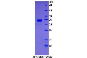 SDS-PAGE analysis of Human SHBG Protein. (SHBG Protéine)