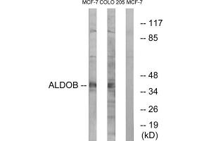 Western blot analysis of extracts from MCF-7 cells and HUVEC cells, using ALDOB antibody. (ALDOB anticorps  (Internal Region))