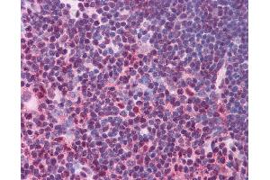 Immunohistochemistry (IHC) image for anti-Signal Transducer and Activator of Transcription 3 (Acute-Phase Response Factor) (STAT3) (Middle Region) antibody (ABIN2792239)