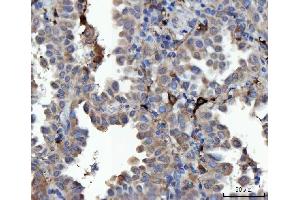 IHC analysis of MSF/SEPTIN9 using anti-MSF/SEPTIN9 antibody (ABIN7600104). (Septin 9 anticorps  (AA 15-282))