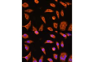 Immunofluorescence analysis of L929 cells using GST3/GST3/GSTP1 Rabbit pAb (ABIN6131722, ABIN6141480, ABIN6141481 and ABIN6221347) at dilution of 1:100 (40x lens).