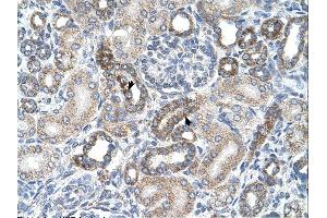UST antibody was used for immunohistochemistry at a concentration of 4-8 ug/ml. (UST anticorps  (C-Term))