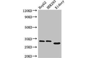 Western Blot Positive WB detected in: HepG2 whole cell lysate, HEK293 whole cell lysate, Mouse kidney tissue All lanes: GEMIN8 antibody at 4 μg/mL Secondary Goat polyclonal to rabbit IgG at 1/50000 dilution Predicted band size: 29 kDa Observed band size: 29, 33 kDa (GEMIN8 anticorps  (AA 1-242))