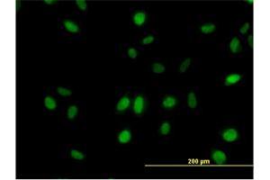 Immunofluorescence of monoclonal antibody to SURB7 on HeLa cell. (MED21 anticorps  (AA 1-144))
