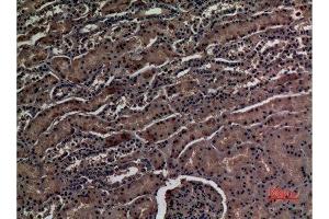 Immunohistochemistry (IHC) analysis of paraffin-embedded Human Kidney, antibody was diluted at 1:100.