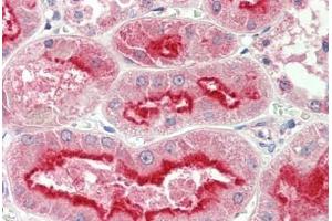 Human Kidney: Formalin-Fixed, Paraffin-Embedded (FFPE) (APMAP anticorps  (AA 74-123))