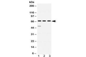 Western blot testing of 1) rat spleen, 2) mouse thymus and 3 human HeLa lysate with ABCE1 antibody at 0. (ABCE1 anticorps)