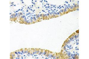Immunohistochemistry of paraffin-embedded Mouse lung using TOB2 Polyclonal Antibody at dilution of 1:100 (40x lens). (TOB2 anticorps)