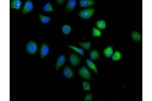 Immunofluorescence staining of A549 cells with ABIN7143677 at 1:120,counter-stained with DAPI.