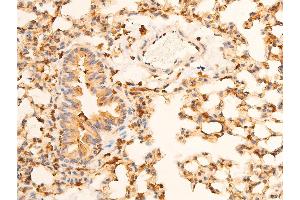 ABIN6267069 at 1/100 staining mouse lung tissue sections by IHC-P.