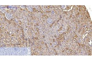 Immunohistochemistry of paraffin-embedded Rat kidney tissue using MAP1LC3A Monoclonal Antibody at dilution of 1:200.