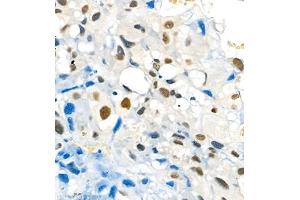 Immunohistochemistry of paraffin embedded rat placenta using Skar (ABIN7074970) at dilution of 1:1800 (400x lens) (p46 anticorps)