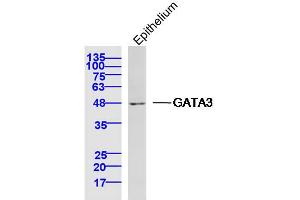 Mouse epithelium lysates probed with GATA3 Polyclonal Antibody, Unconjugated  at 1:300 dilution and 4˚C overnight incubation. (GATA3 anticorps  (AA 151-250))