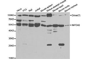 Western blot analysis of extracts of various cell lines, using IMPDH2 antibody (ABIN5973086) at 1/1000 dilution. (IMPDH2 anticorps)