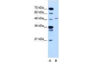 WB Suggested Anti-TYRP1 Antibody Titration:  2. (Tyrosinase-Related Protein 1 anticorps  (N-Term))