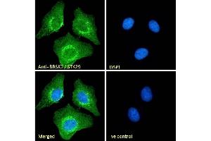 (ABIN185503) Immunofluorescence analysis of paraformaldehyde fixed U2OS cells, permeabilized with 0. (BRSK2 anticorps  (Internal Region))