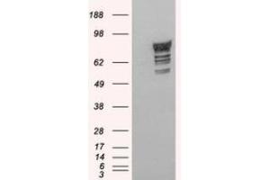 Image no. 1 for anti-phosphodiesterase 4D, cAMP-Specific (PDE4D) (C-Term) antibody (ABIN374635) (PDE4D anticorps  (C-Term))