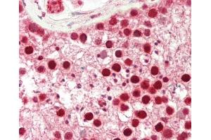 Formalin-fixed and paraffin-embedded H.